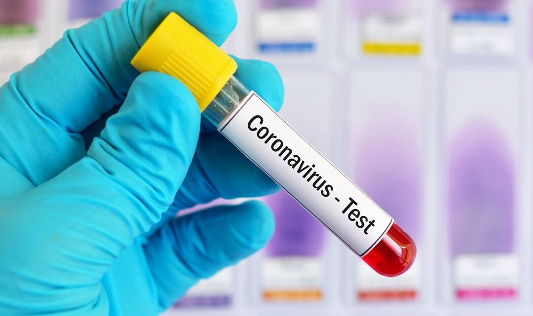 COVID 19 Testing Available in Fayette County with some Limitations